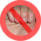 Stop Onicofagia